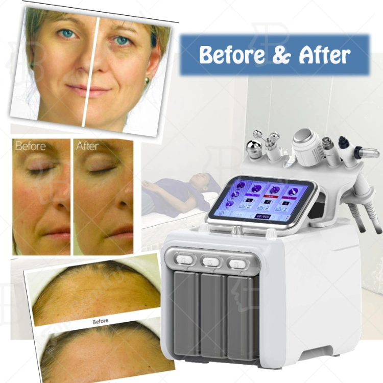 Portable Water Microdermabrasion Aqua Jet Peel Dermabrasion Hydro Facial Machine